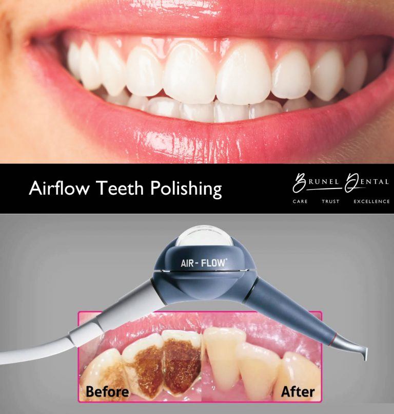 Dental Hygienist Swindon Brunel Dental Practice