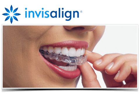 invisalign