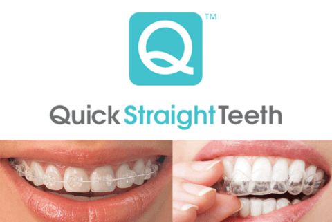 quick straight teeth