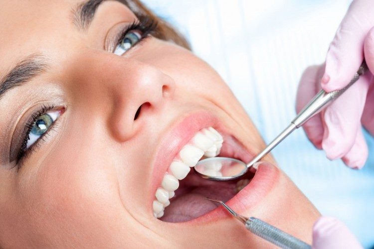 types of dental fillings