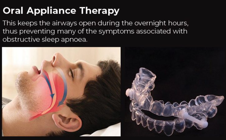 dentist can provide an alternative to CPAP for sleep apnoea