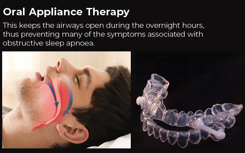 dentist can provide an alternative to CPAP for sleep apnoea