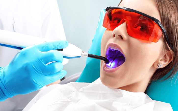 what to know about laser dentistry