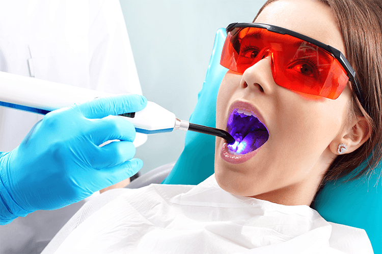 what to know about laser dentistry