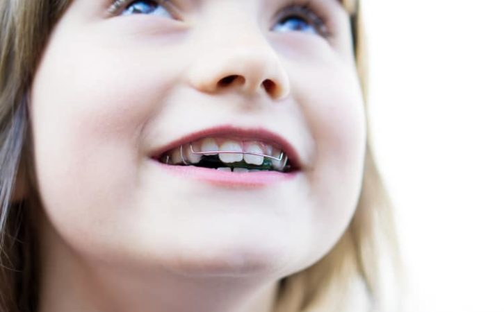 when should my child have braces